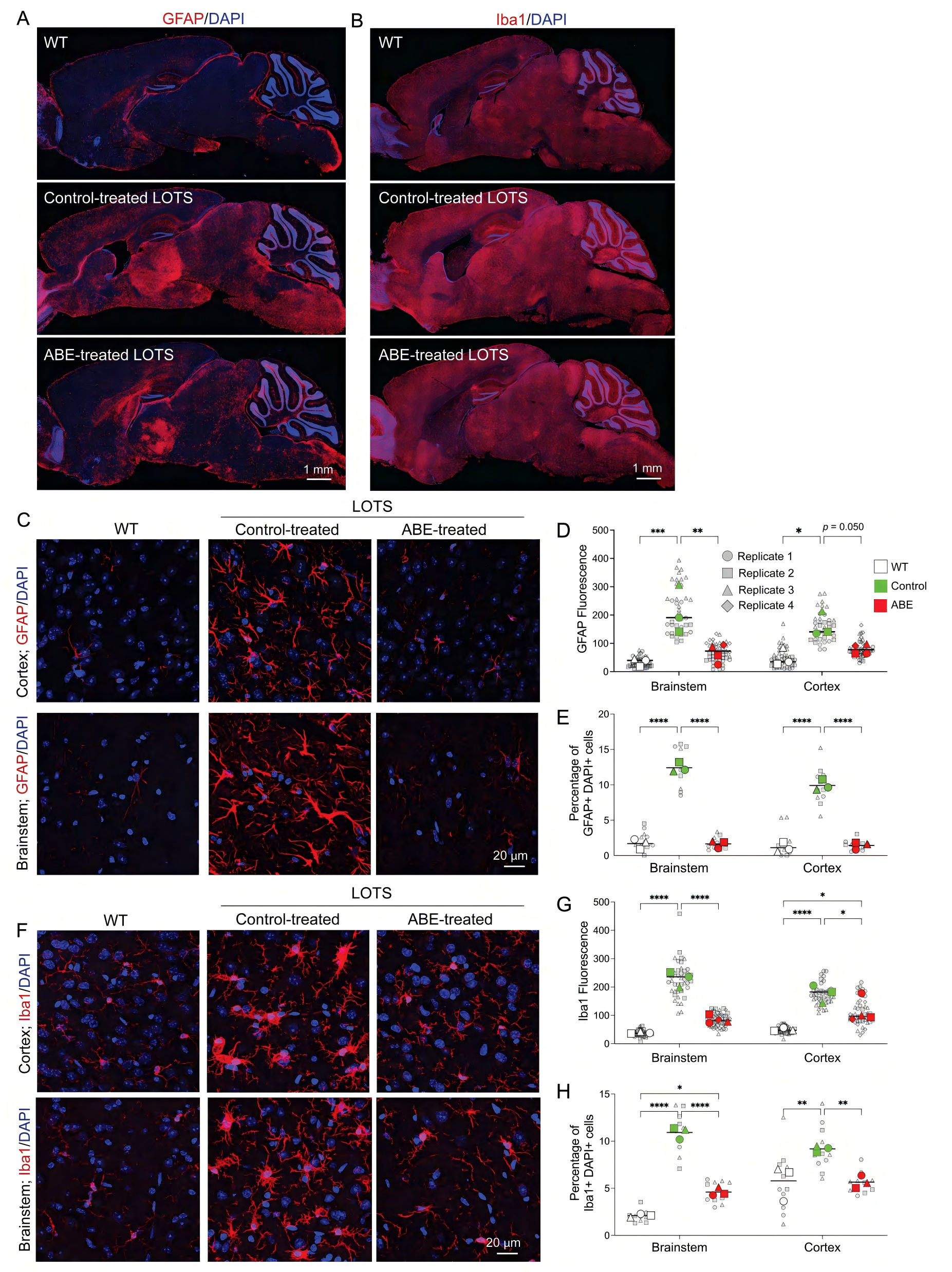 LOTS小鼠脑内胶质细胞病理变化