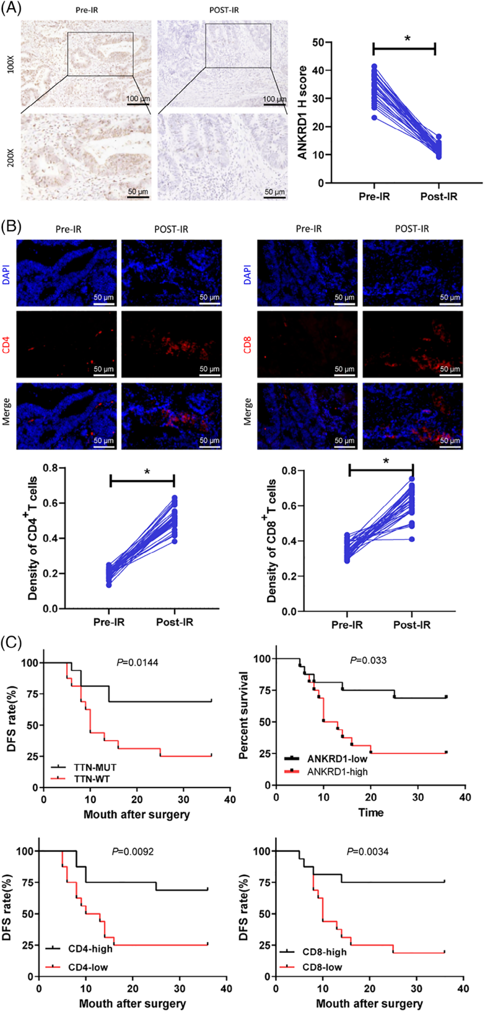 TTN突变介导的免疫原性激活及其与READ患者放射治疗结果的相关性分析